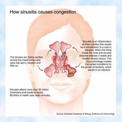 Sinus Infections Advanced Cardiology And Primary Care Llc